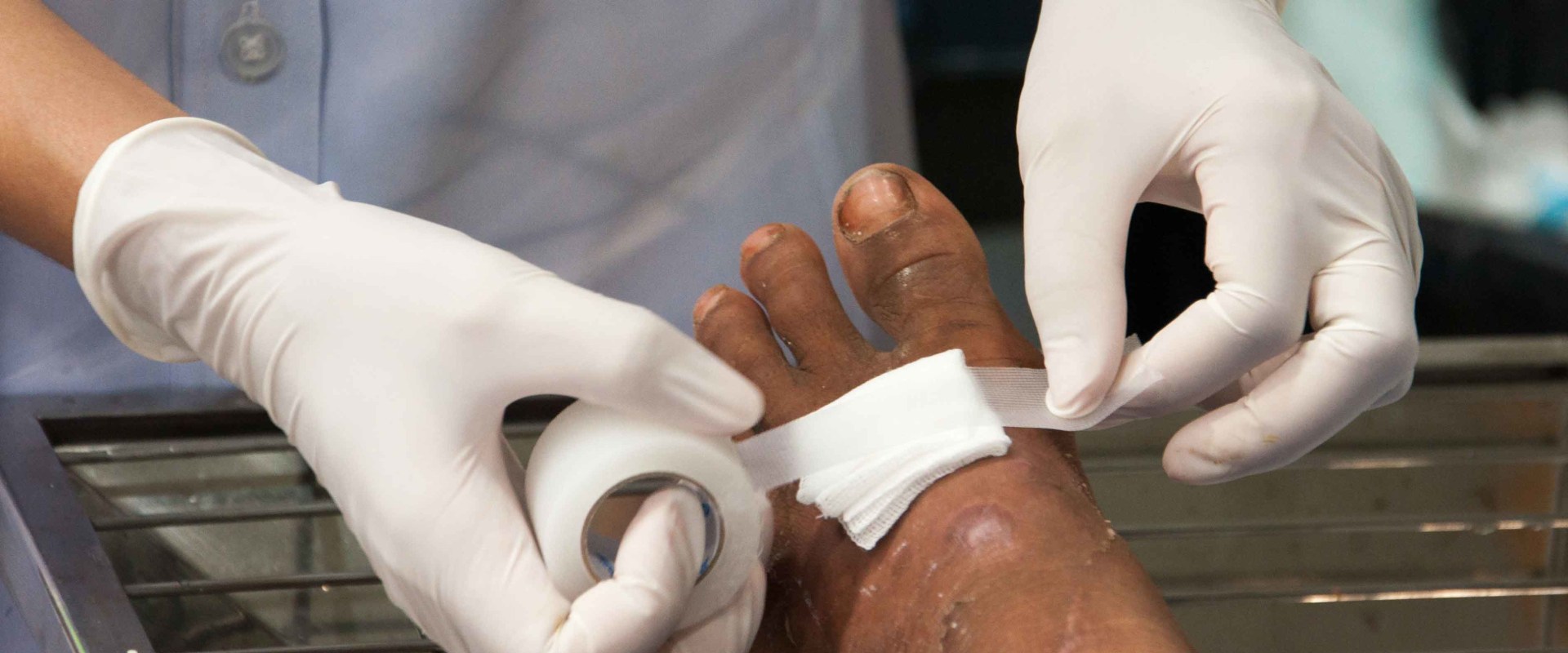 The 5 Essential Principles of Wound Management: A Comprehensive Guide