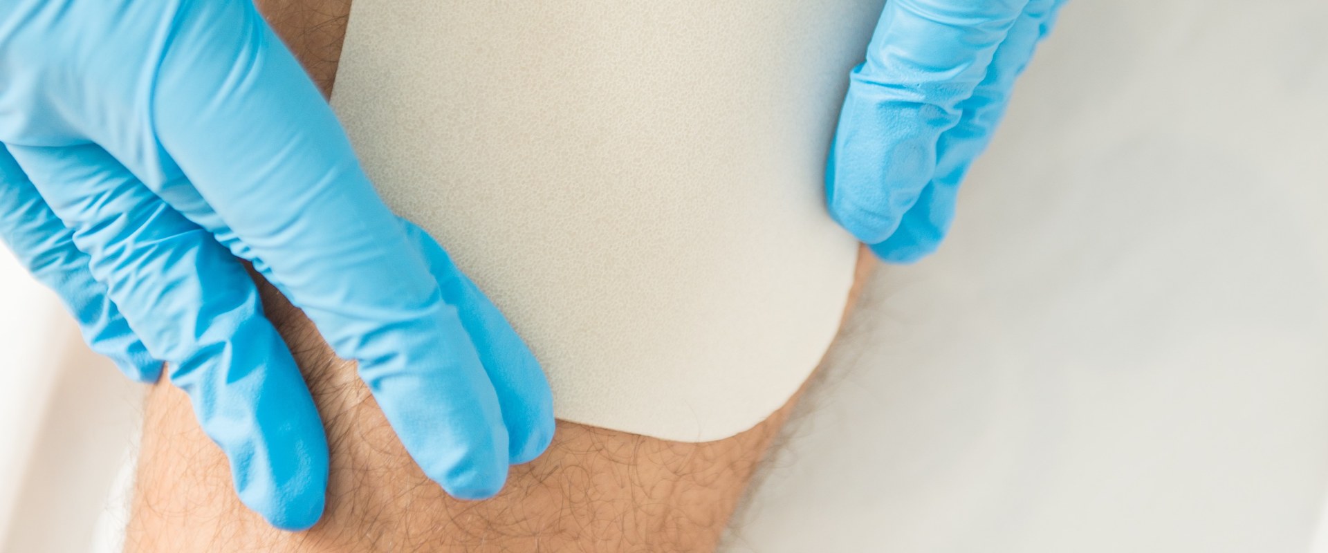 The Ultimate Guide to Choosing the Perfect Wound Dressing