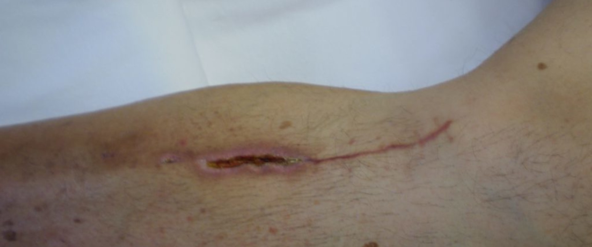 The Power of a Comprehensive Wound Assessment