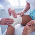 The Importance of a Multidisciplinary Approach in Wound Care