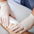 The 6 Characteristics of an Ideal Wound Dressing