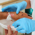 Maximizing Recovery With Effective Wound Care Management and Trusted Assessments