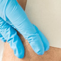 The Importance of Proper Wound Assessment for Effective Healing