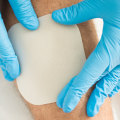 The Ultimate Guide to Wound Care in Nursing