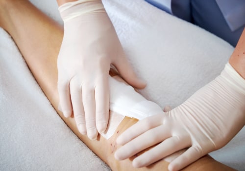 The 6 Characteristics of an Ideal Wound Dressing