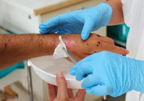 Maximizing Recovery With Effective Wound Care Management and Trusted Assessments