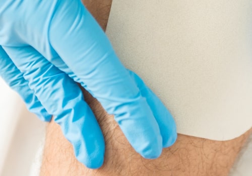 The Importance of Proper Wound Assessment for Effective Healing